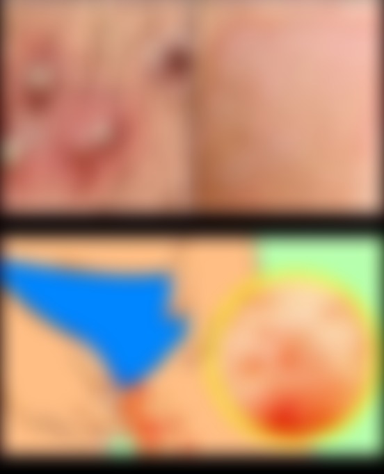 THESE ARE THE SIGNS THAT IT IS CR! SEE MORE