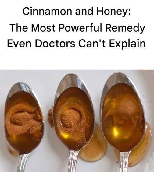 Cinnamon and Honey! The Most Powerful Remedy Even Doctors Cannot Explain